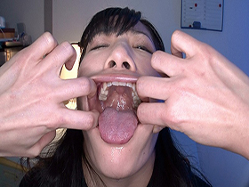 超大量痰唾責め唾液うがい飲み顔面ぬるぬるレズ　サンプル画像12